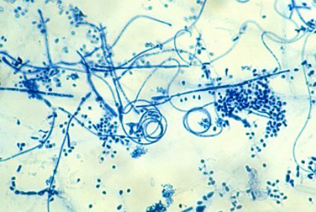 Pėdų epidermofitozės (Trichophyton interdigitale) sukėlėjas.